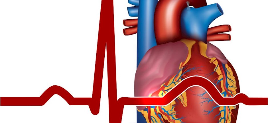 Τι είναι η Βραδυκαρδία και πως αντιμετωπίζεται